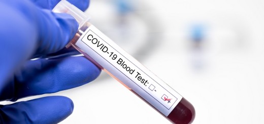 COVID-19 coronavirus positive blood sample diagnosed in hospital