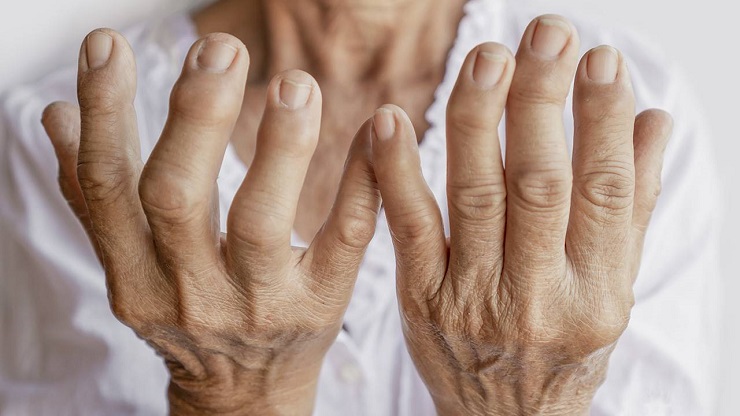 same-suplementación-combate-la-artritis