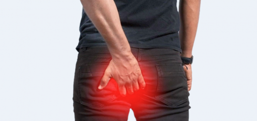 remedios-naturales-para-mejorar-las-hemorroides