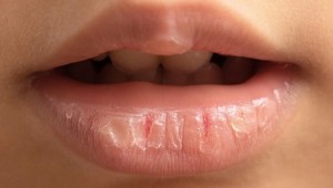 bálsamos-labiales-para-el-invierno