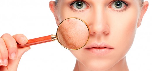 cómo-proteger-tu-piel-durante-el-invierno-rosácea