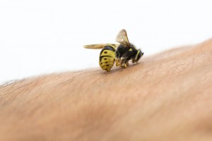Cómo_deshinchar_una_picadura_de_abeja